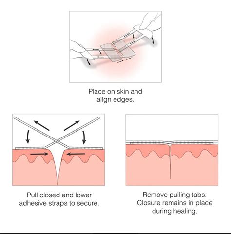 Emergency Wound Laceration Kit | 8 Pcs – Invest in Survival