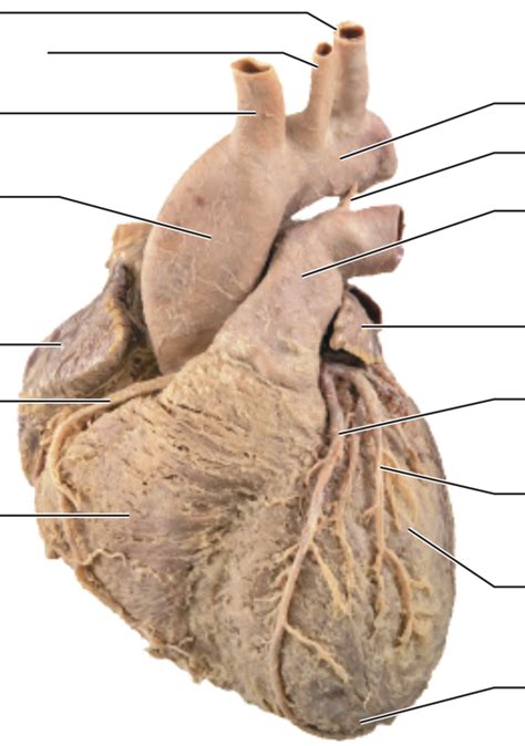 Diagram 18 5 A Marieb Anatomie Hart Quizlet