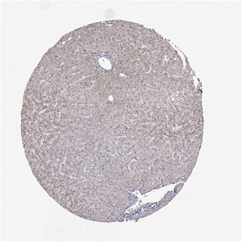 Tissue Expression Of Bdnf Staining In Liver The Human Protein Atlas