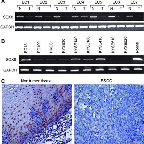 Downregulation Of SOX6 In ESCC SOX6 Expression Was Frequently