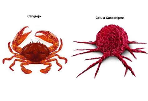 Cáncer de Mama – AMOH