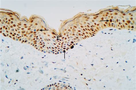 Immunohisto chemical localization of ERα A and ERß B in