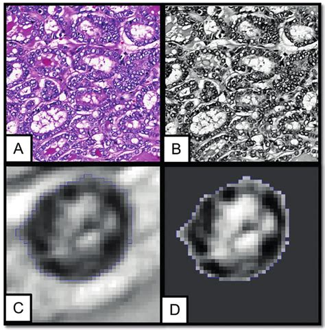 Slide Photo Exemplifying The Morphometric Analysis Of The Histological