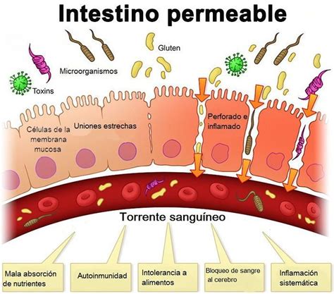 Permeabilidad Intestinal O S Ndrome De Leaky Gut Cega