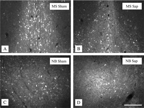 Parvalbumin Positive Interneuron Cell Bodies And Processes Were