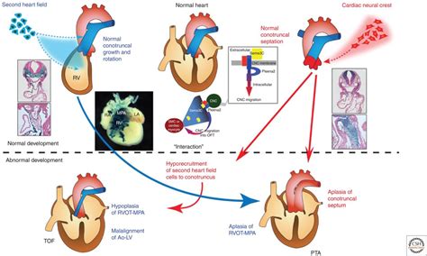 Cardiac Neural Crest