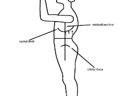 Make a transverse incision of 1.2 cm at the posterior axillary line ...