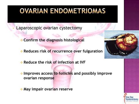 Endometriosis and laparoscopy when and how