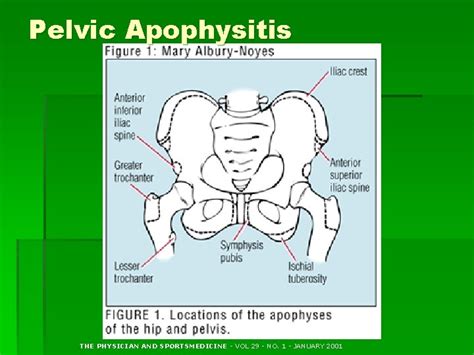 Hip Pelvis And Thigh Problems Anatomy Evaluation And