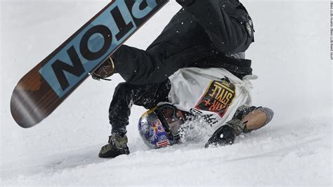 Who Is Most At Risk For A Snowboard Wrist Injury Sicuro