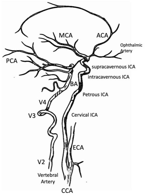 Anatomia Free Full Text Anatomy Of Cerebral Arteries With Clinical ...