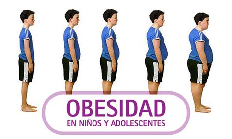 Prevalencia Y Factores De Riesgo De Obesidad En Adolescentes