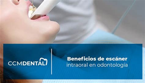 Beneficios de escáner intraoral en odontología CCM Dental