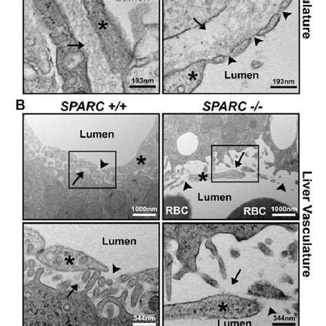 Microvessel Structure In Organs From Tumor Bearing Sparc And