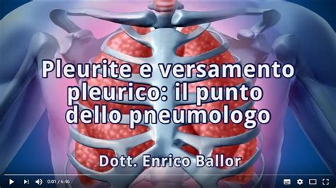 Pleurite E Versamento Pleurico Il Punto Dello Pneumologo Youtube