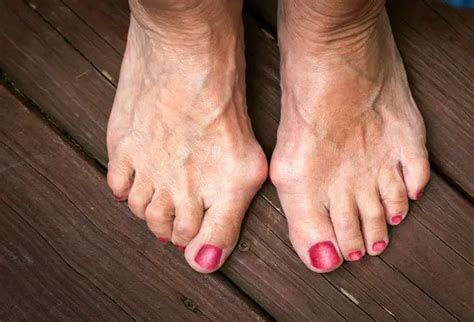 What Is The Knot On The Inside Of My Foot