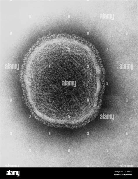 Parainfluenza Virus Transmission Electron Micrograph Of A Section