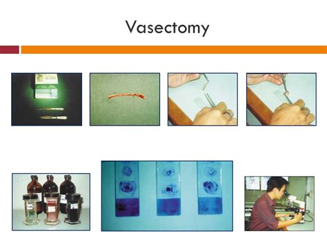 Suppawiwat Ponglowhapan Dvm Hons Ms Msc Phd Ppt ดาวน์โหลด