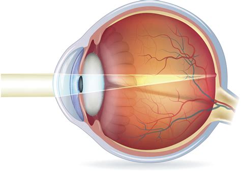 How Does Vision Actually Work Lasik Eye Surgery Grand Junction