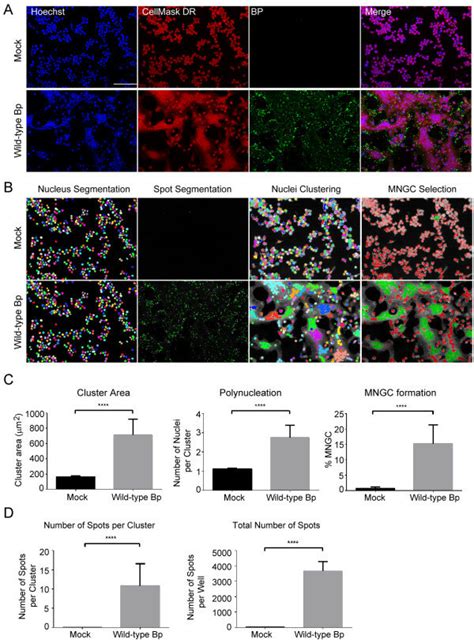 Quantitative Analysis Of B Pseudomallei K96243 Induced Murine