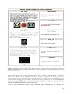 Towards Generalist Foundation Model For Radiology Deepai