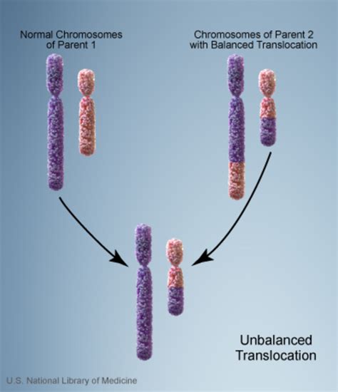 Cri-du-chat syndrome: MedlinePlus Genetics