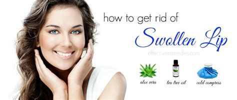 Revealed: 14 Ways How To Get Rid Of Swollen Lip Fast & Naturally