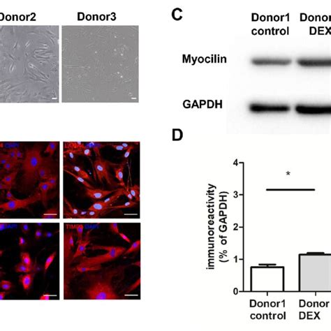 Morphological And Functional Characterization Of Normal Human TM Cells