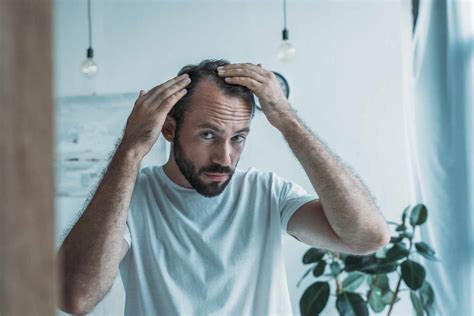 18 Prescriptions That Cause Hair Loss Silver Pines