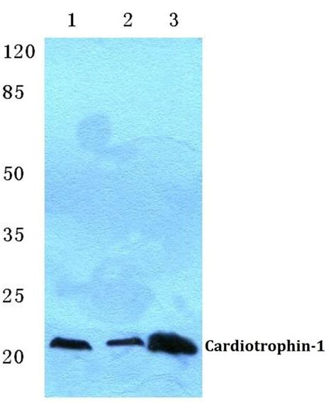 Cardiotrophin 1 Polyclonal Antibody Invitrogen 100 μL Unconjugated