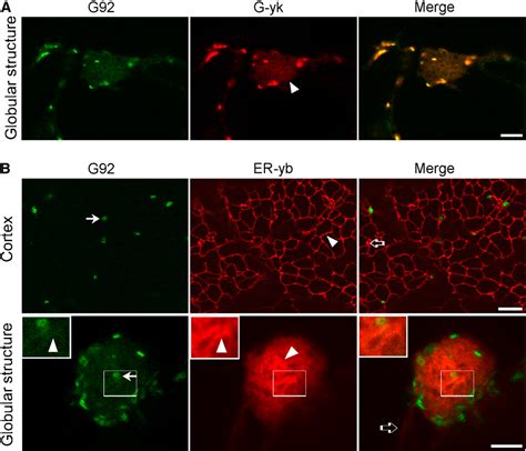 Figure From A Missense Mutation In The Arabidopsis Copii Coat Protein