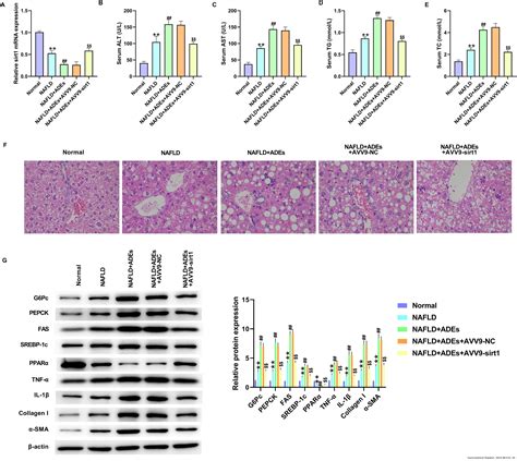 Adipocytes Derived Exosomal Mir 122 Promotes Non Alcoholic Fat Liver