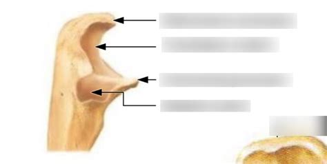 Ulnar Diagram #2 Diagram | Quizlet