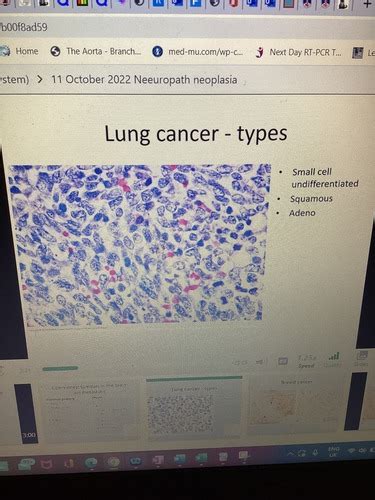 Neuropathology Lectures Flashcards Quizlet