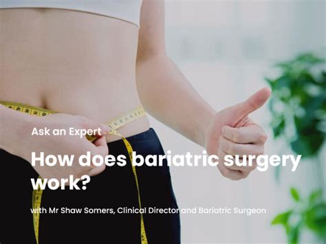 How Bariatric Surgery Works Shaw Somers Streamline Surgical