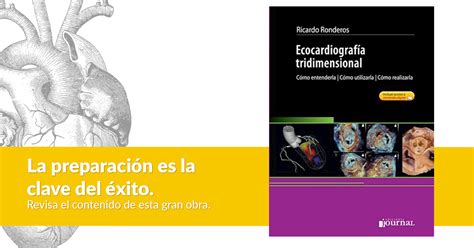 Libro Ecocardiograf A Tridimensional Era Edici N En Campus