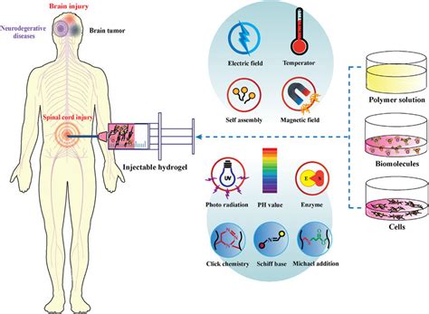 Schematic Illustration Of Different Approaches For Injectable Hydrogel