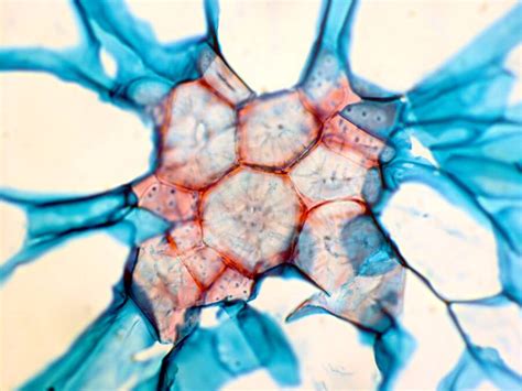 Cell Types, Sclereids