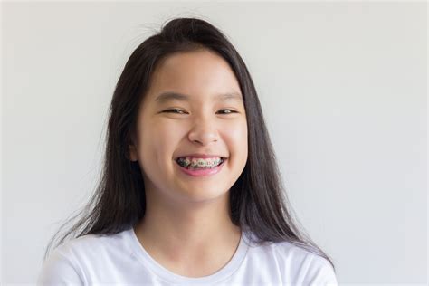 How to Care For Your Child's Braces - Viva Smiles | Family & Kids ...