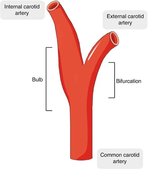 Common Carotid Artery Bifurcation