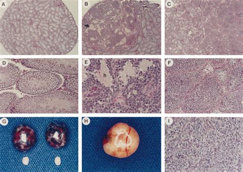 Gross And Histological Analysis Of The Testes And Testicular Tumors