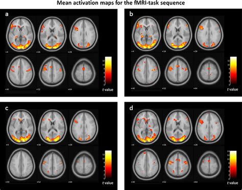 Mean Brain Activation Maps For The Task FMRI Sequences Panel A Mean