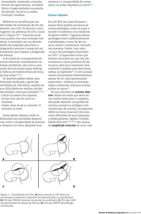 A Origem Do Conceito De Conflito Femoro Acetabular Cfa Remonta A