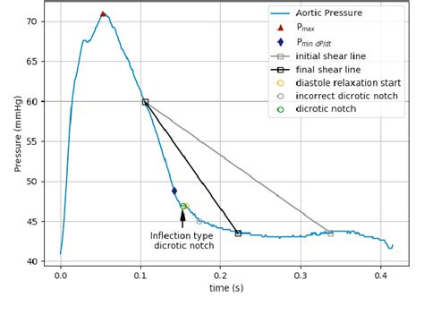 Figure 2 from Accurate dicrotic notch detection using adaptive shear transforms | Semantic Scholar