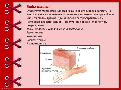 Первая помощь при ожогах - презентация онлайн