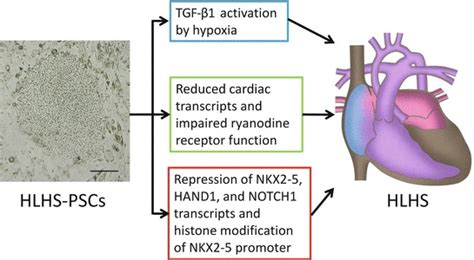 Fig 471 Psc Technology Models Hlhs Three Etiology And