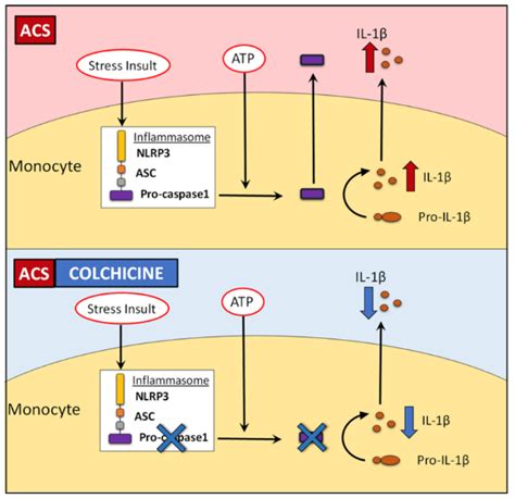 The Use of Colchicine in Pericardial Diseases - American College of ...