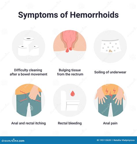 Symptoms Of External Hemorrhoids The Hemorrhoidal Node In The Rectum