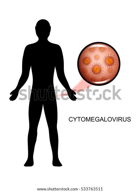 Vector Illustration Man Suffering Cytomegalovirus Silhouette Stock