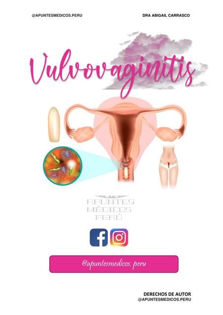 Vulvovaginitis Enfermedad transmisión sexual Tricomona Candida